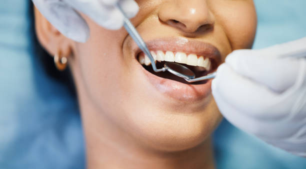 Best Emergency Root Canal Treatment in Potosi, TX