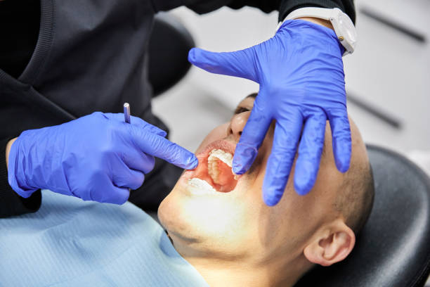 Best Emergency Broken Tooth Repair in Potosi, TX
