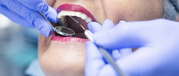 Best Emergency Tooth Extraction in Potosi, TX